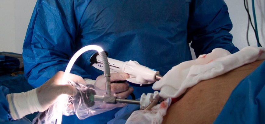 Breast Examination & Surgeries